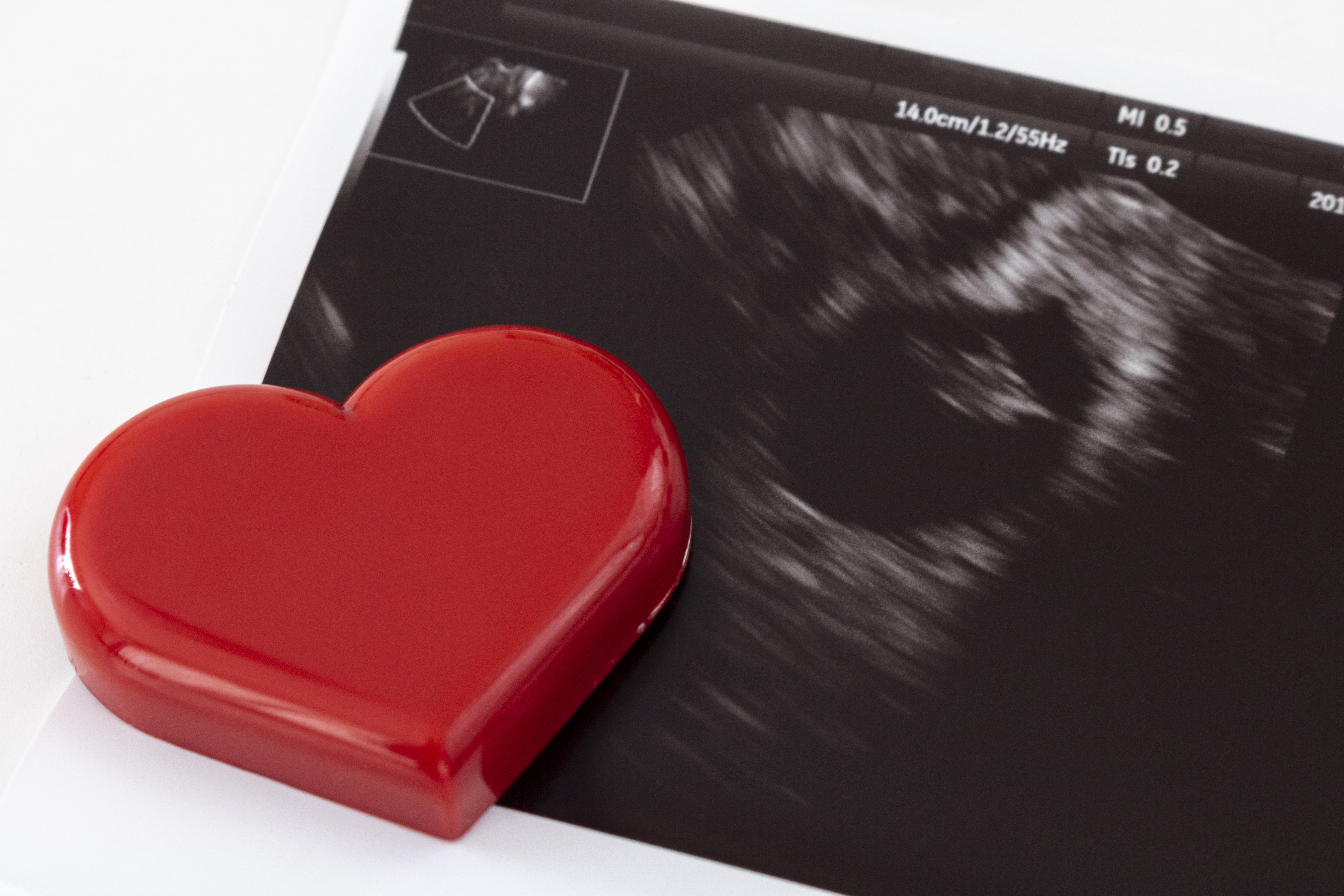 妊娠13週のエコー写真にはどんな特徴がある 胎児や妊婦の状態は Nipt 新型出生前診断 のコラム 平石クリニック