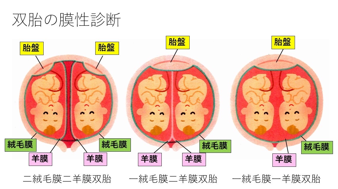 膜性